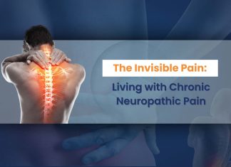 Treatments for Neuropathic Pain and Empathy: Naprosyn 500 mg and Flexabenz ER 15 mg